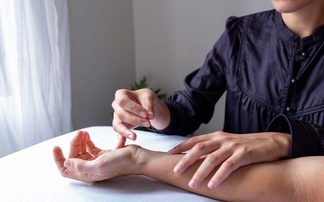 The Ancient Art of Healing: Discover the Benefits of Acupuncture for Modern Wellness