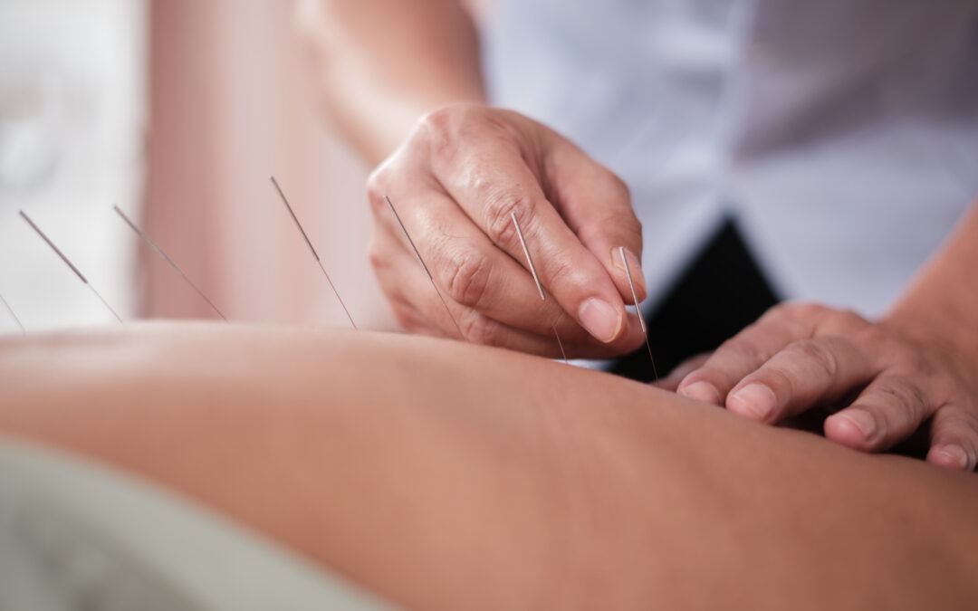 The Power of Acupuncture Benefits: A Path to Holistic Healing