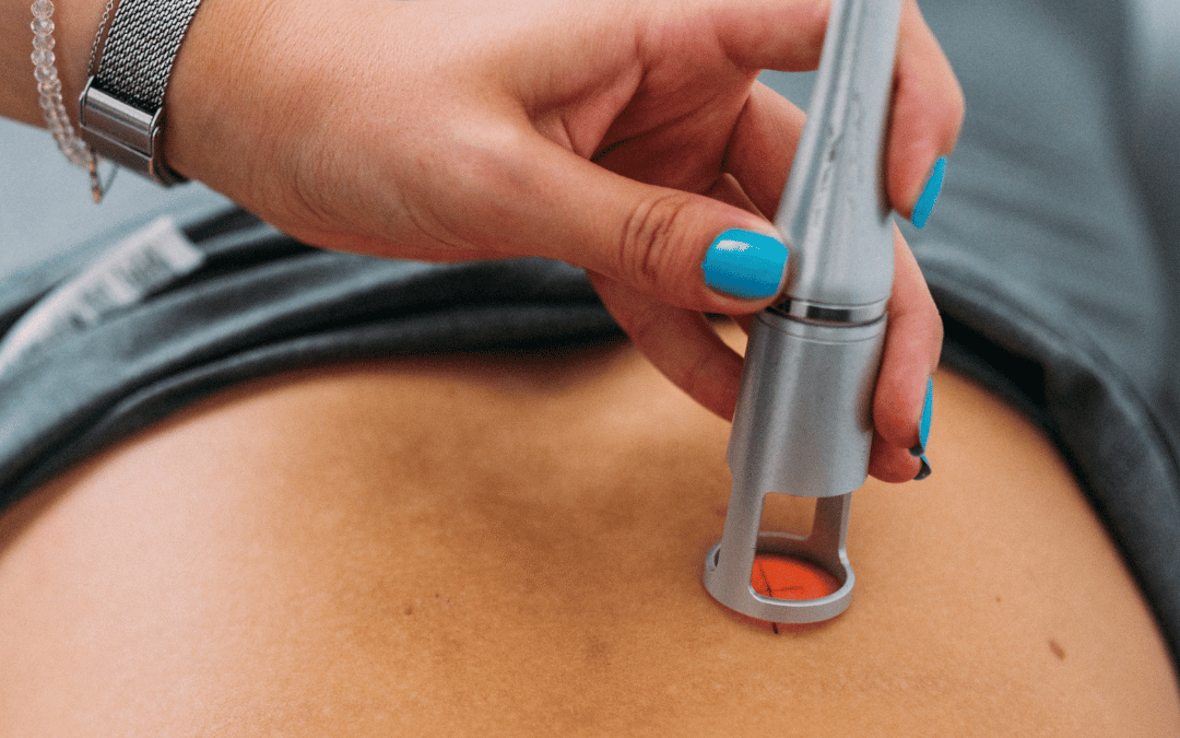 The 30‑Watt Difference: Why Most Mississauga Clinics Use Underpowered Lasers—and How We Reach the Root Cause Faster