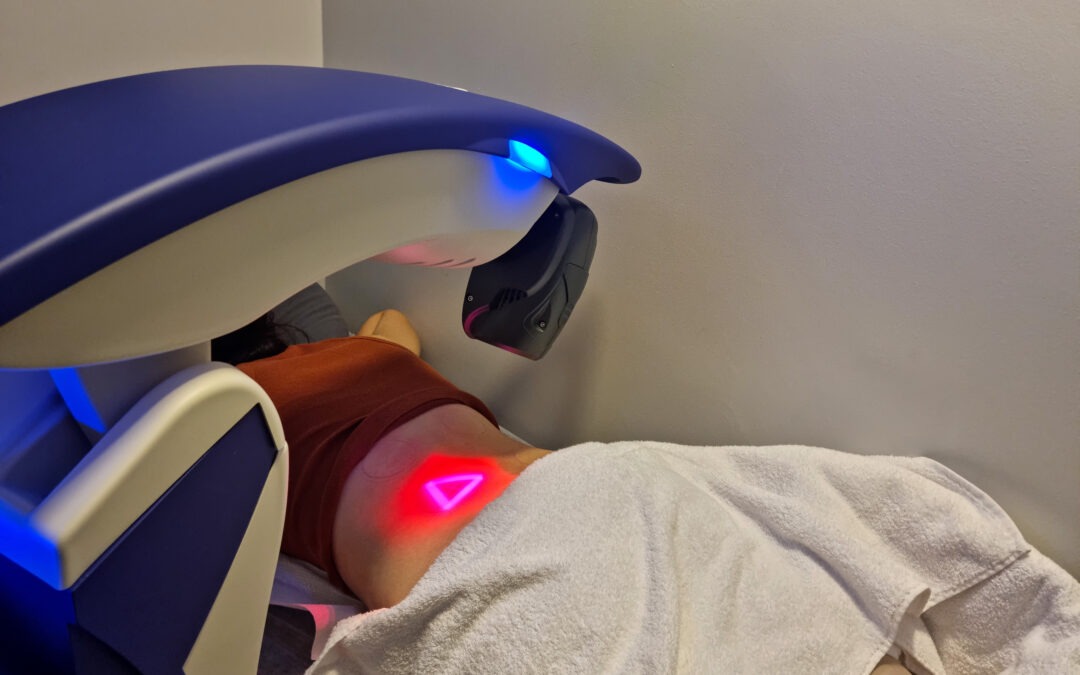 High‑Intensity Laser Therapy for Sciatica in Port Credit, Mississauga: A Deep‑Tissue Solution?