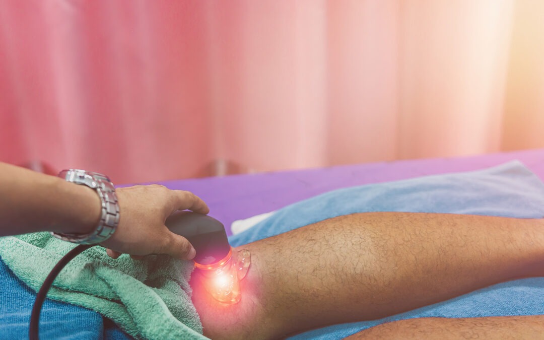 Local Athlete’s Guide: Managing Running Injuries with Advanced Laser Therapy in Port Credit