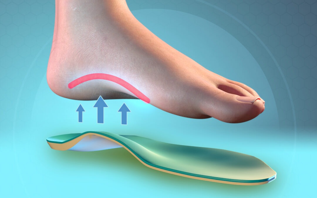 Custom orthotics explained: how better foot support can improve the way you move