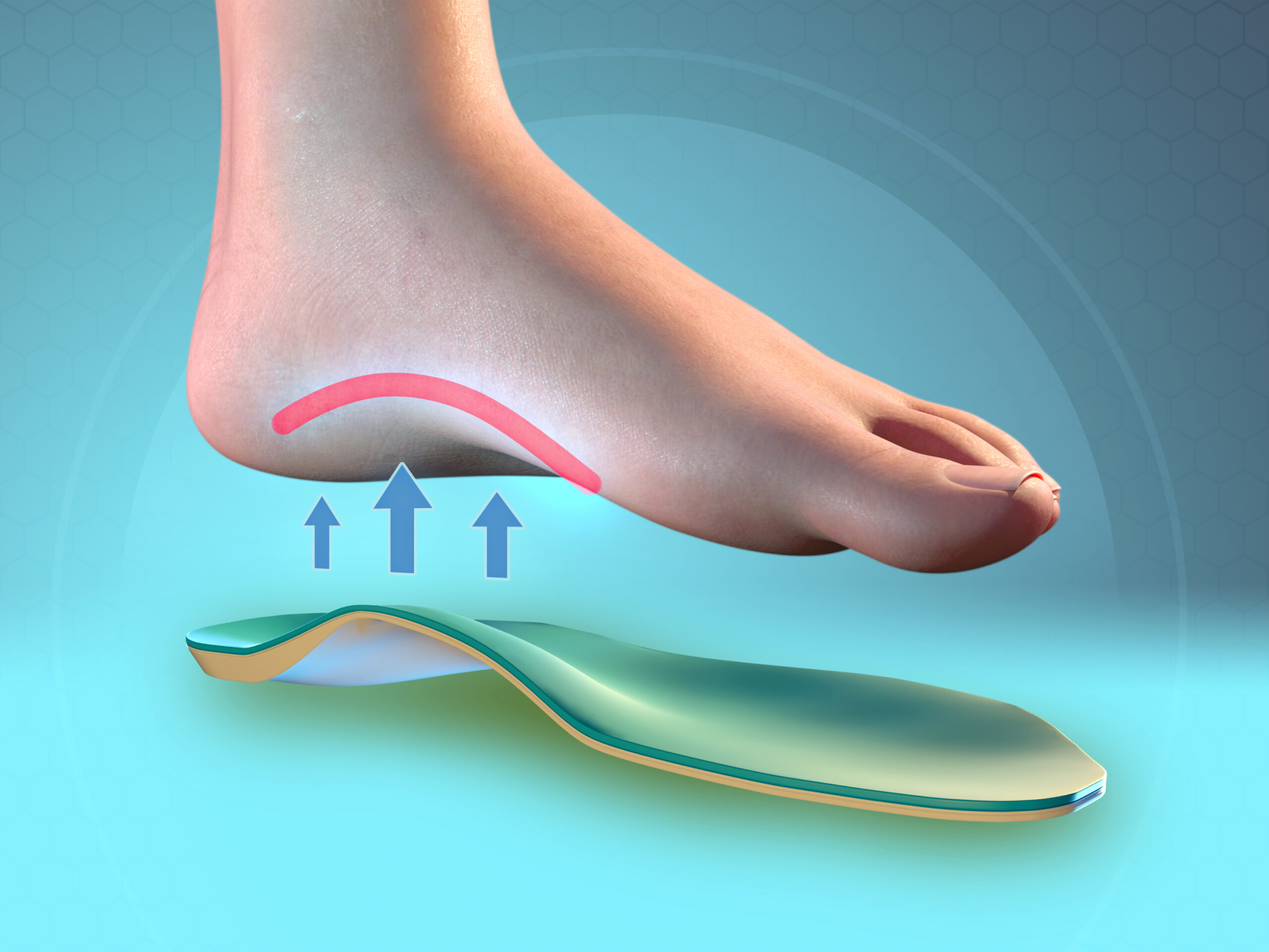 MyHealth Care Centre - Port Credit, Mississauga 1 custom orthotics explained: how better foot support can improve the way you move
